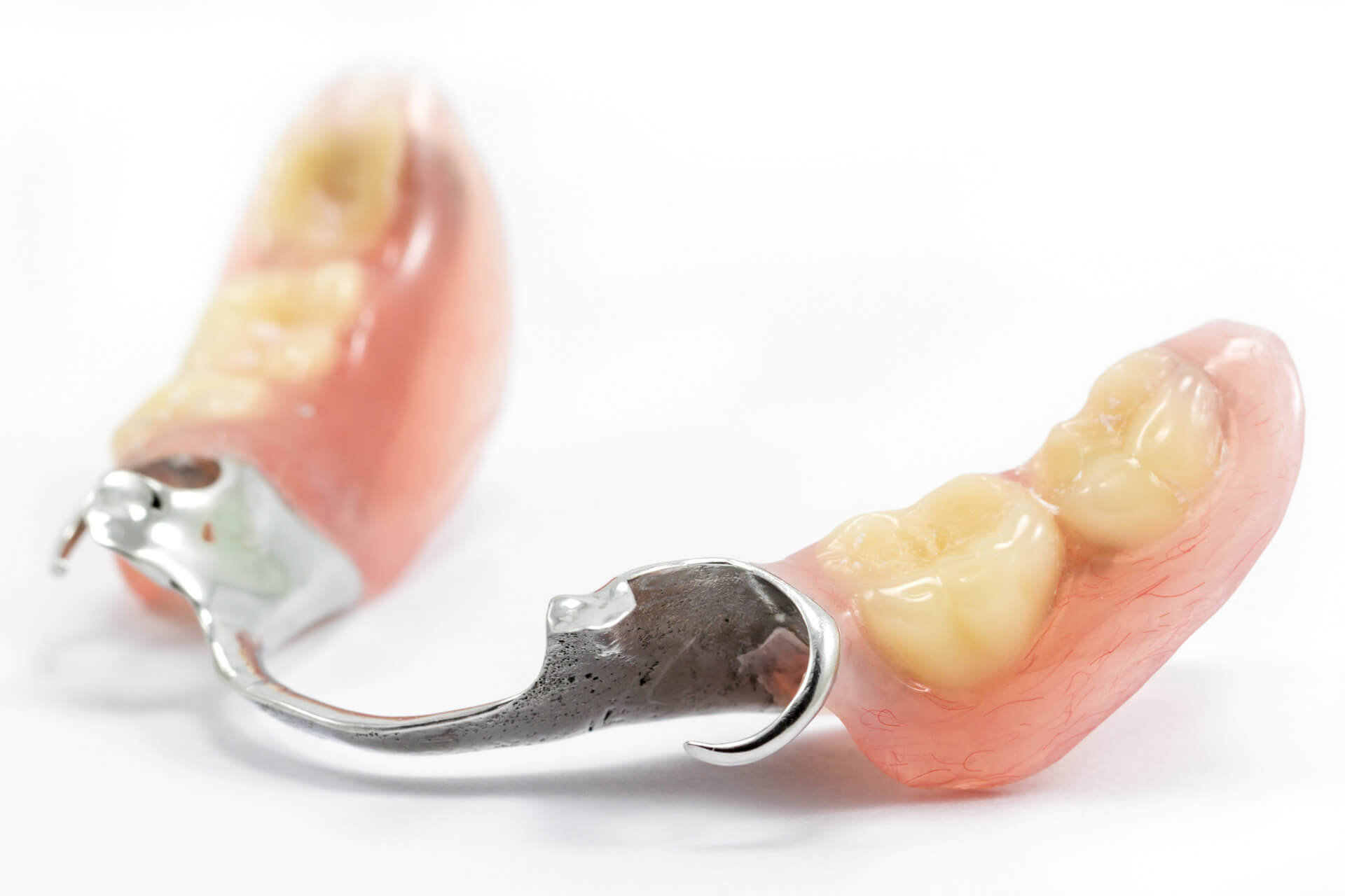 入れ歯・義歯治療